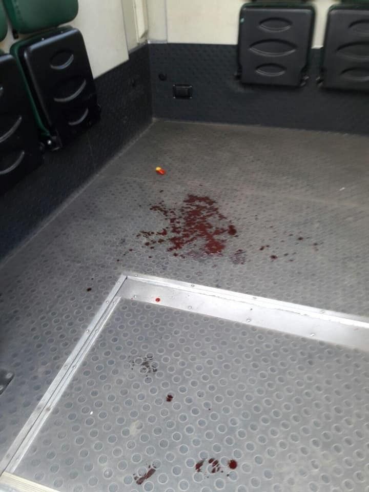 В Киеве в маршрутке мужчина разбил девушке нос из-за замечания